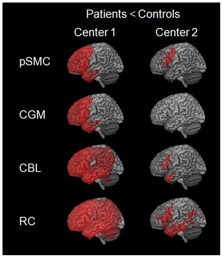 https://cdn.ncbi.nlm.nih.gov/pmc/blobs/4360/3581522/a635e99aae3d/pone.0055415.g002.jpg
