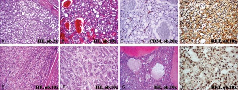 https://cdn.ncbi.nlm.nih.gov/pmc/blobs/4362/4603009/6275b9193427/medi-94-e1189-g004.jpg