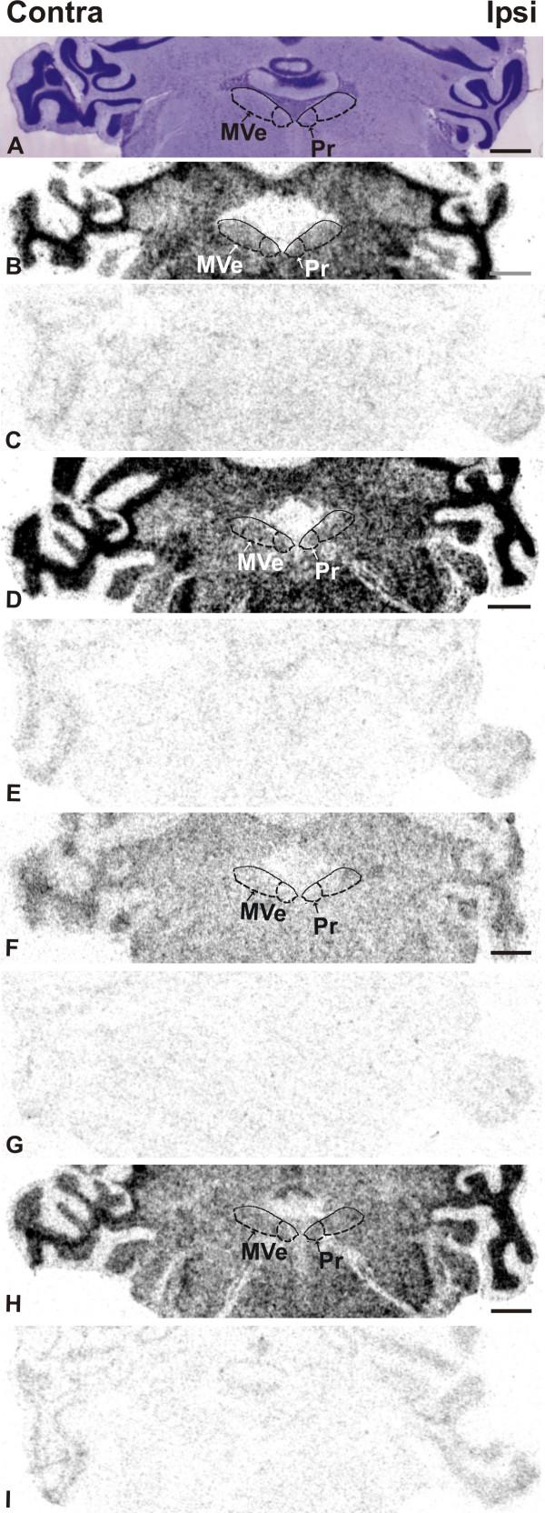 https://cdn.ncbi.nlm.nih.gov/pmc/blobs/4362/517932/ad7218e426a2/1471-2202-5-32-2.jpg