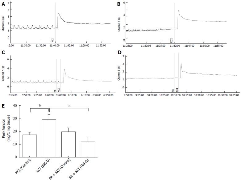 https://cdn.ncbi.nlm.nih.gov/pmc/blobs/4362/5807672/44673540e04d/WJG-24-693-g003.jpg
