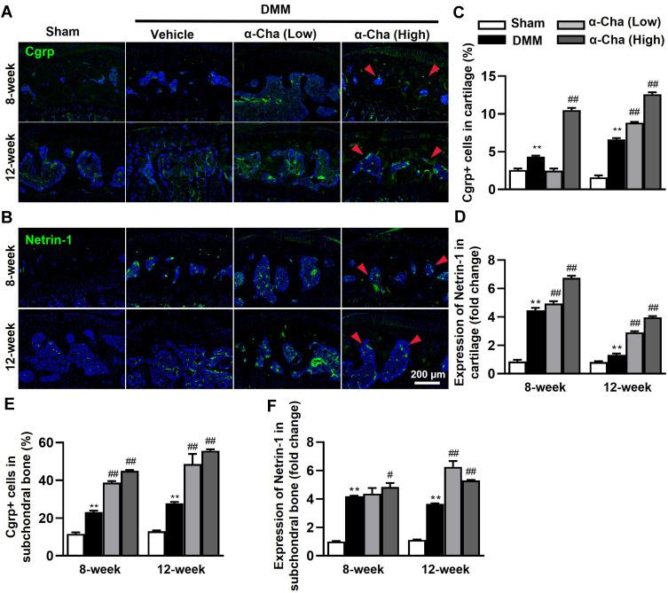 https://cdn.ncbi.nlm.nih.gov/pmc/blobs/4369/9574566/cbf80017f2f2/JIR-15-5873-g0006.jpg