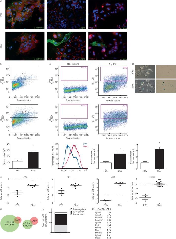 https://cdn.ncbi.nlm.nih.gov/pmc/blobs/436c/5593348/91d183f40eab/ERJ-02367-2016.03.jpg