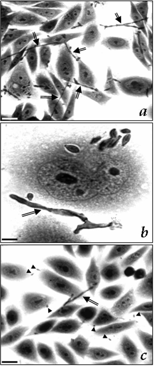 https://cdn.ncbi.nlm.nih.gov/pmc/blobs/437e/2557140/1fa4010da3e0/pone.0003382.g004.jpg