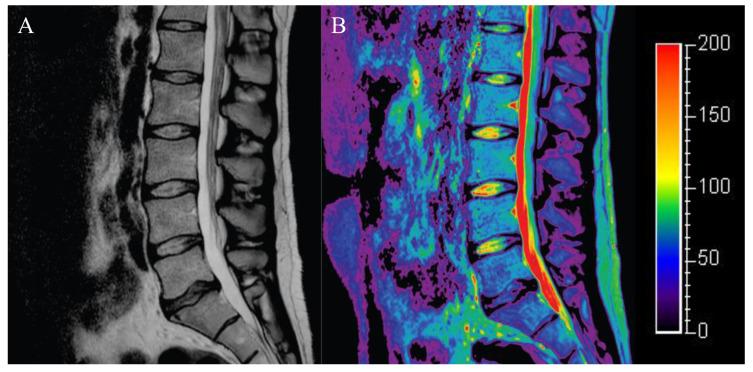 https://cdn.ncbi.nlm.nih.gov/pmc/blobs/438d/8946895/1b96def3156f/diagnostics-12-00707-g004.jpg