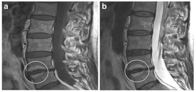 https://cdn.ncbi.nlm.nih.gov/pmc/blobs/438d/8946895/bd28a8f85e76/diagnostics-12-00707-g002.jpg