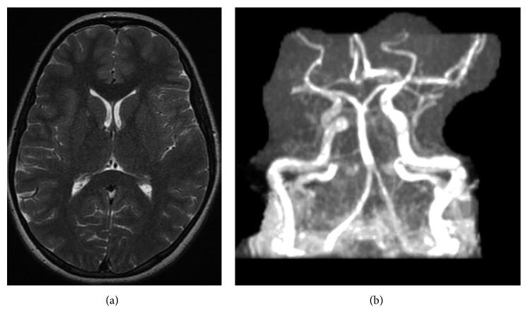 https://cdn.ncbi.nlm.nih.gov/pmc/blobs/4394/6594285/c17cc8e5c103/CRIRH2019-8157969.004.jpg