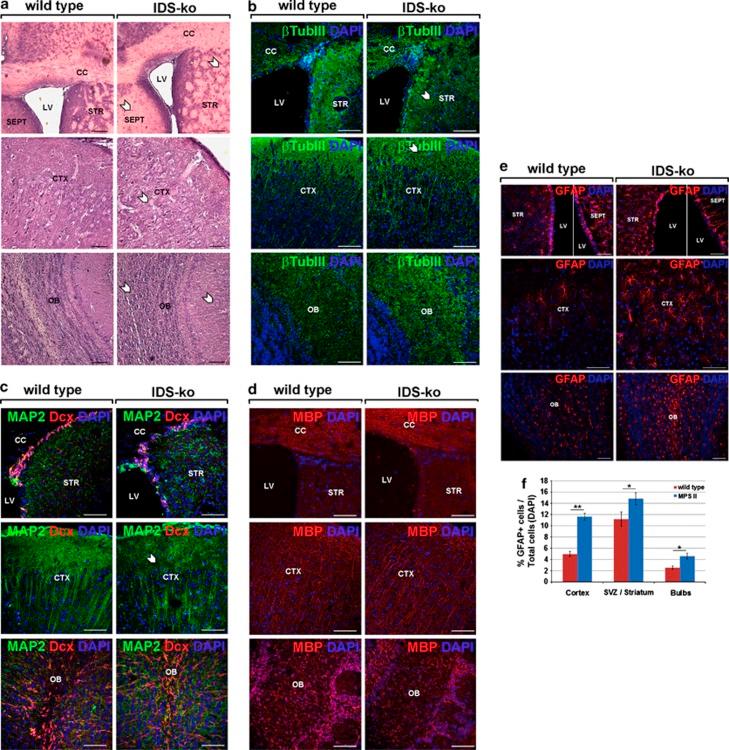 https://cdn.ncbi.nlm.nih.gov/pmc/blobs/4397/3847312/a9c483ddc56d/cddis2013430f4.jpg