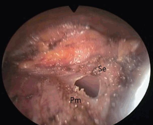 https://cdn.ncbi.nlm.nih.gov/pmc/blobs/439a/5869434/1ab72f57502e/aps-2017-01263f5.jpg