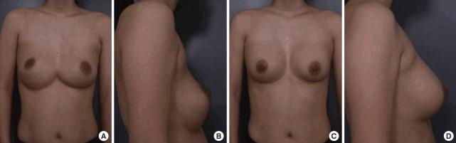 https://cdn.ncbi.nlm.nih.gov/pmc/blobs/439a/5869434/4827affda9ff/aps-2017-01263f8.jpg