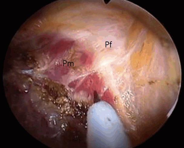 https://cdn.ncbi.nlm.nih.gov/pmc/blobs/439a/5869434/f4655e1c9d98/aps-2017-01263f2.jpg