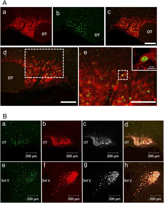 https://cdn.ncbi.nlm.nih.gov/pmc/blobs/439c/5691068/00b5914e1731/41598_2017_16049_Fig2_HTML.jpg