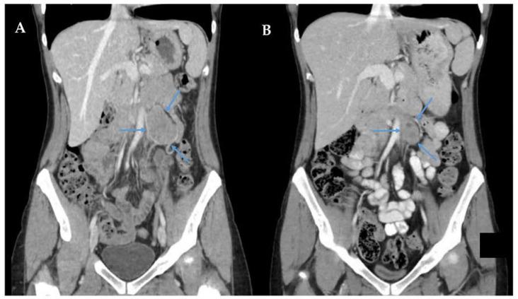 https://cdn.ncbi.nlm.nih.gov/pmc/blobs/439e/10377910/56cab80a57ac/curroncol-30-00445-g002.jpg