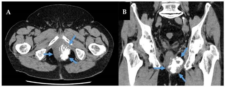 https://cdn.ncbi.nlm.nih.gov/pmc/blobs/439e/10377910/df8f388c2954/curroncol-30-00445-g003.jpg
