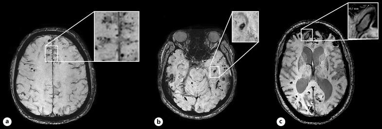 https://cdn.ncbi.nlm.nih.gov/pmc/blobs/43a5/12324689/1a179d368768/ced-2025-0054-0004-540899_F01.jpg