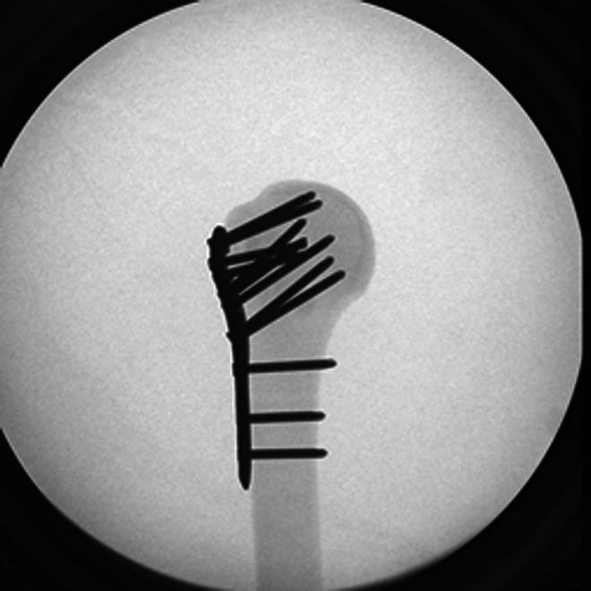 https://cdn.ncbi.nlm.nih.gov/pmc/blobs/43a6/7876747/599bdf6b44fe/10.1177_2151459321992744-fig2.jpg