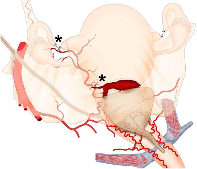 https://cdn.ncbi.nlm.nih.gov/pmc/blobs/43a7/11823370/2d2b077452a9/IJGO-168-987-g003.jpg