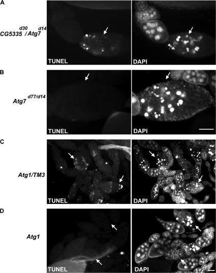 https://cdn.ncbi.nlm.nih.gov/pmc/blobs/43a9/2542474/dae4732c7cf3/jcb1821127f07.jpg