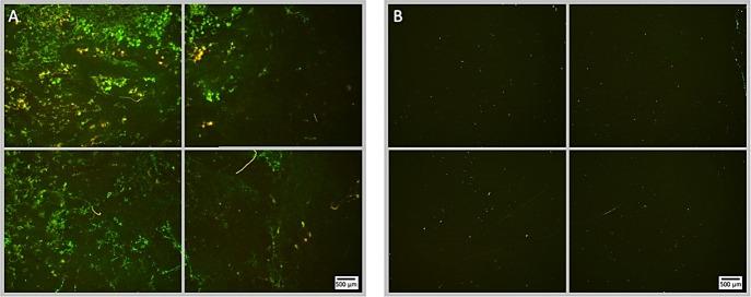 https://cdn.ncbi.nlm.nih.gov/pmc/blobs/43ac/9386126/f37d3ad1ead1/fcimb-12-956808-g004.jpg