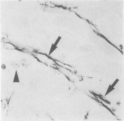 https://cdn.ncbi.nlm.nih.gov/pmc/blobs/43c2/498383/895d8a6cccb3/jclinpath00512-0038-b.jpg
