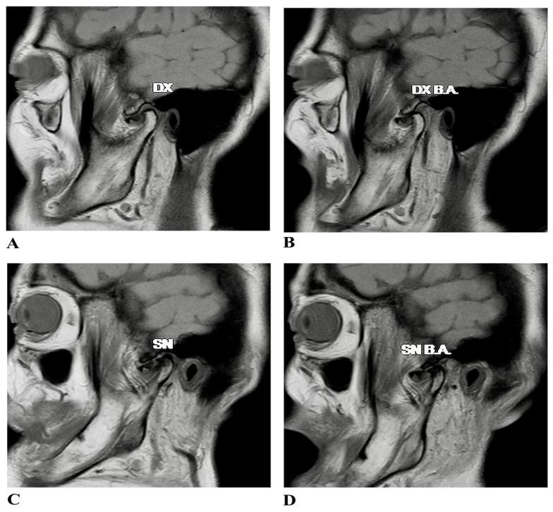 https://cdn.ncbi.nlm.nih.gov/pmc/blobs/43c5/12015778/55956b24a5cc/jfmk-10-00107-g001.jpg