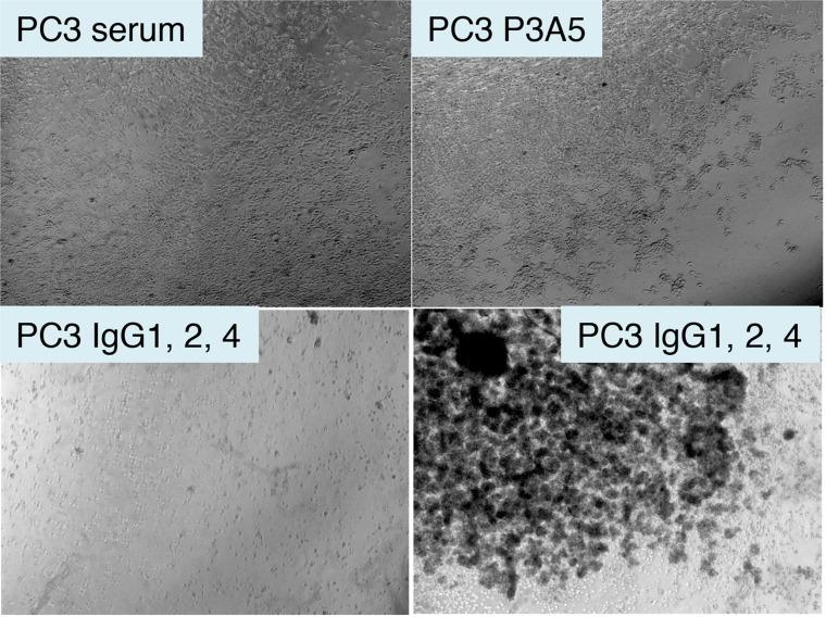 https://cdn.ncbi.nlm.nih.gov/pmc/blobs/43c6/6611513/3f940c29729f/oncotarget-10-4276-g006.jpg