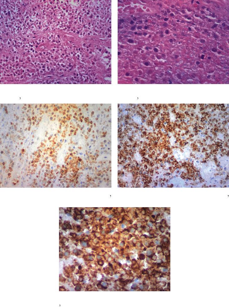 https://cdn.ncbi.nlm.nih.gov/pmc/blobs/43d3/9173911/20270b8b14a5/CRIONM2022-4162832.003.jpg