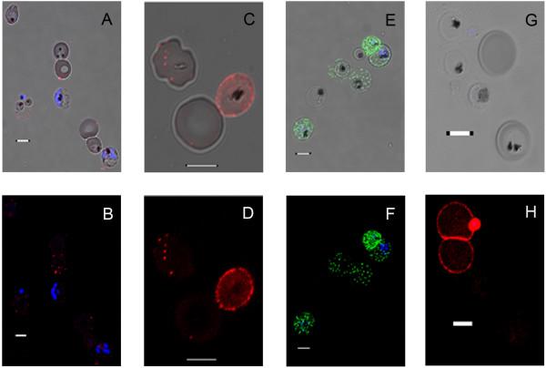 https://cdn.ncbi.nlm.nih.gov/pmc/blobs/43d4/2868858/167a3aefdc92/1475-2875-9-100-1.jpg