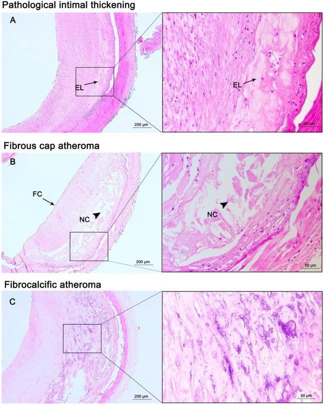 https://cdn.ncbi.nlm.nih.gov/pmc/blobs/43d7/5622314/956cbf8863c4/fneur-08-00488-g002.jpg