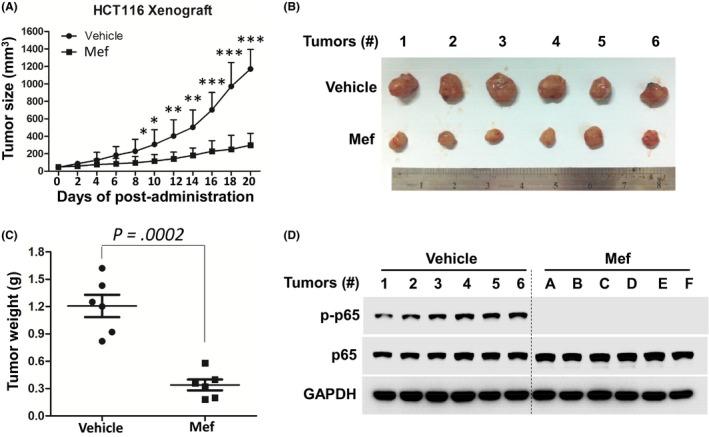 https://cdn.ncbi.nlm.nih.gov/pmc/blobs/43d7/5891192/28bc313a4d86/CAS-109-1220-g005.jpg