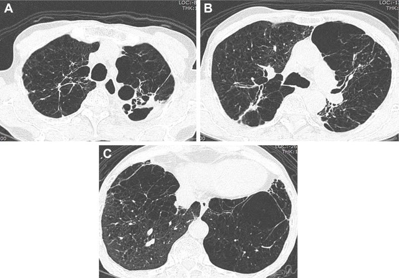 https://cdn.ncbi.nlm.nih.gov/pmc/blobs/43dc/5841335/2af099be78ed/copd-13-761Fig4.jpg
