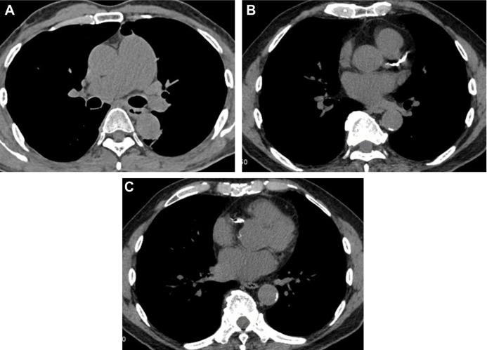 https://cdn.ncbi.nlm.nih.gov/pmc/blobs/43dc/5841335/c6bd3f41fe7b/copd-13-761Fig6.jpg