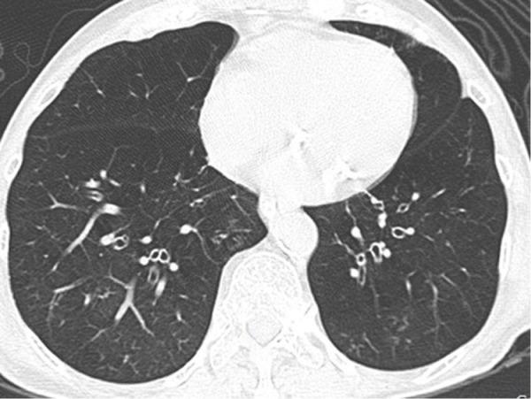 https://cdn.ncbi.nlm.nih.gov/pmc/blobs/43dc/5841335/e8567596b5a4/copd-13-761Fig5.jpg