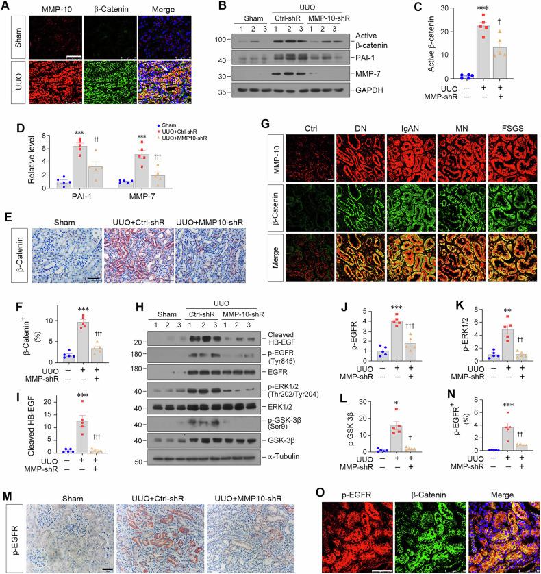 https://cdn.ncbi.nlm.nih.gov/pmc/blobs/43e0/12085647/fafdf44e4fdc/41420_2025_2521_Fig4_HTML.jpg