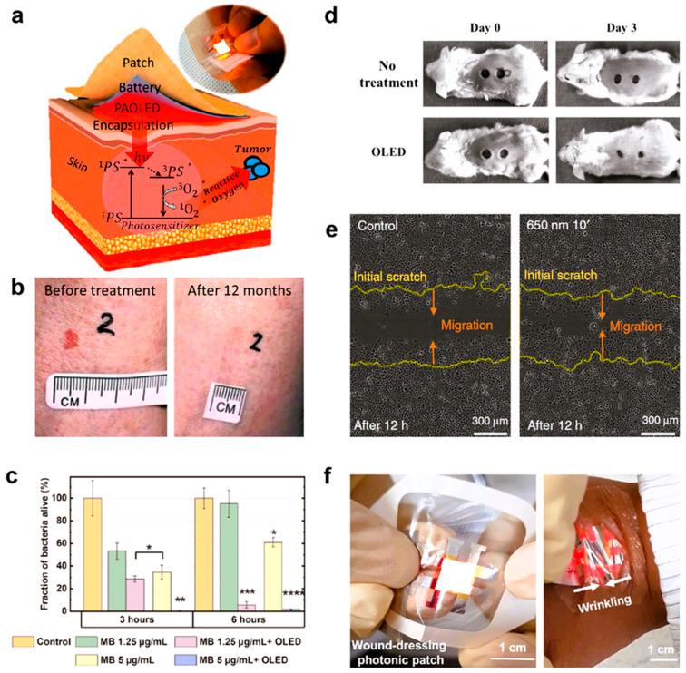 https://cdn.ncbi.nlm.nih.gov/pmc/blobs/43e4/12467551/f8c7a9308044/biosensors-15-00587-g006.jpg
