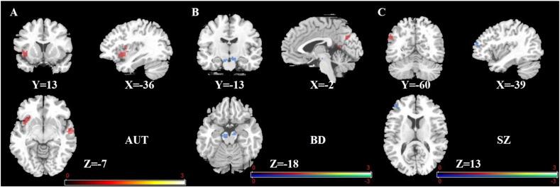 https://cdn.ncbi.nlm.nih.gov/pmc/blobs/43e4/5328751/6b3feb8aa89f/gr3.jpg