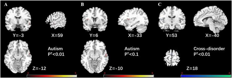 https://cdn.ncbi.nlm.nih.gov/pmc/blobs/43e4/5328751/c6100168d9f4/gr6.jpg