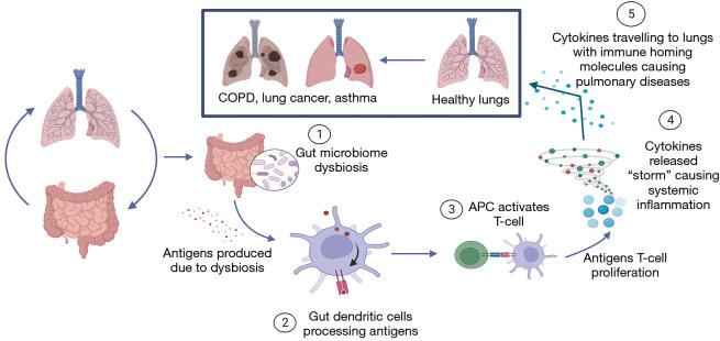 https://cdn.ncbi.nlm.nih.gov/pmc/blobs/43e5/10183407/cdde43e3f47f/tlcr-12-04-909-f2.jpg
