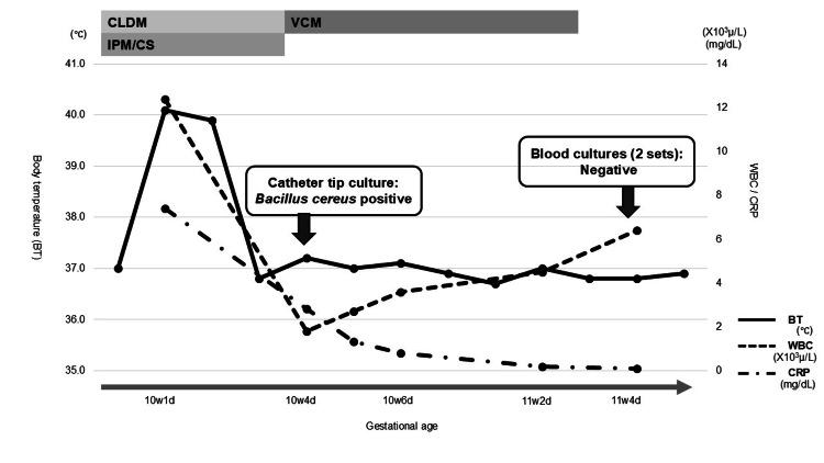 https://cdn.ncbi.nlm.nih.gov/pmc/blobs/43e6/12326162/e96c332c5ad5/cureus-0017-00000087402-i02.jpg