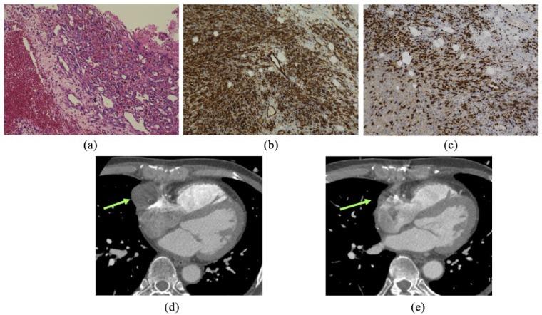 https://cdn.ncbi.nlm.nih.gov/pmc/blobs/43ea/6546942/7c1d35b7b747/10.1177_2632010X19831261-fig2.jpg