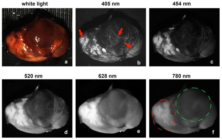 https://cdn.ncbi.nlm.nih.gov/pmc/blobs/43eb/12190702/5a1b77787549/biosensors-15-00352-g004.jpg
