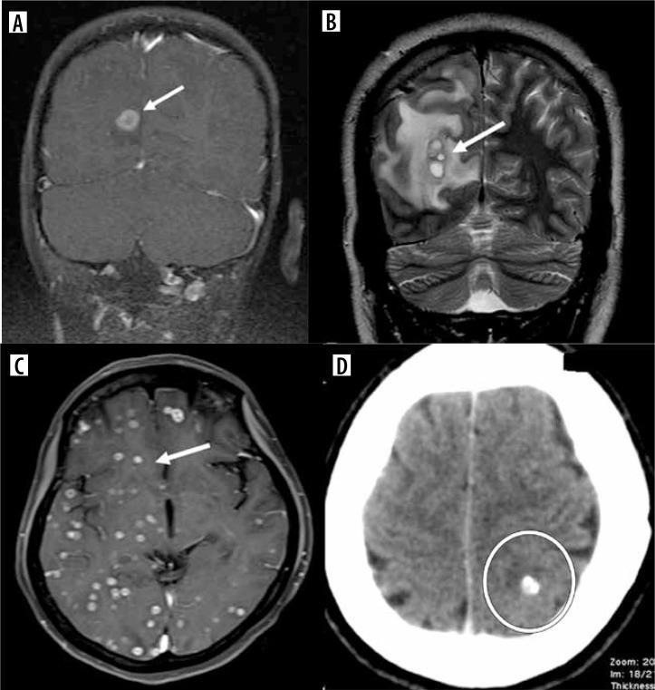https://cdn.ncbi.nlm.nih.gov/pmc/blobs/43ed/11705042/26cba2fc2f90/PJR-89-288904-g003.jpg
