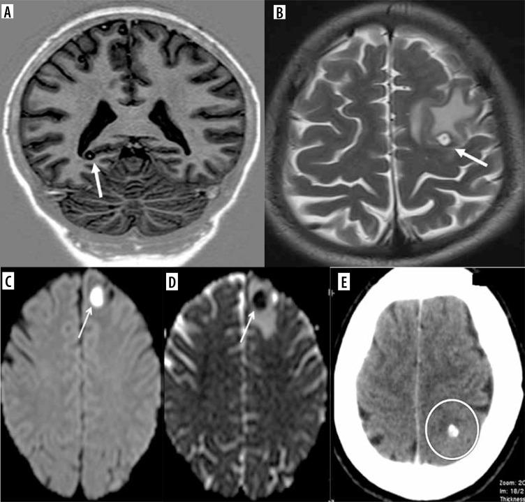 https://cdn.ncbi.nlm.nih.gov/pmc/blobs/43ed/11705042/6aa4c78ecf32/PJR-89-288904-g005.jpg