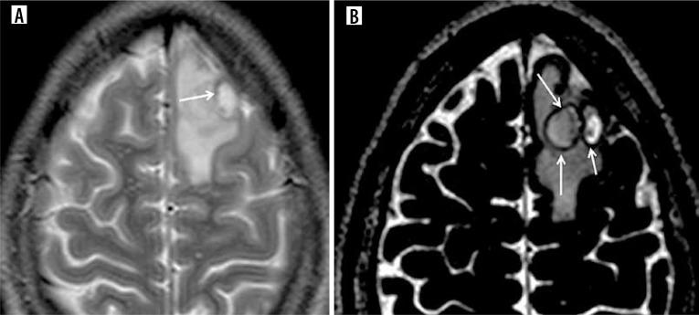 https://cdn.ncbi.nlm.nih.gov/pmc/blobs/43ed/11705042/830b21c52658/PJR-89-288904-g008.jpg