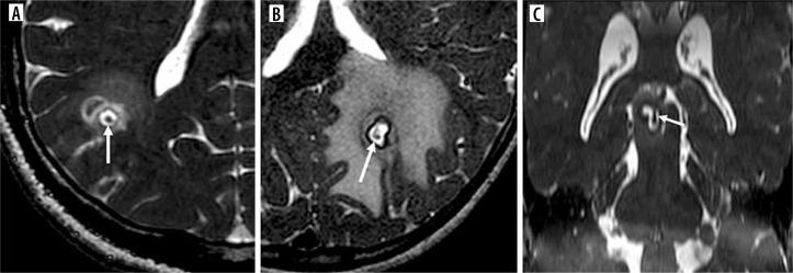 https://cdn.ncbi.nlm.nih.gov/pmc/blobs/43ed/11705042/d504761dbe4d/PJR-89-288904-g007.jpg