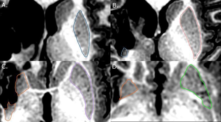 https://cdn.ncbi.nlm.nih.gov/pmc/blobs/43fb/9421529/6daec5c835dd/gr2.jpg