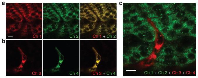 https://cdn.ncbi.nlm.nih.gov/pmc/blobs/4401/3058322/a024355a0971/nihms240064f4.jpg