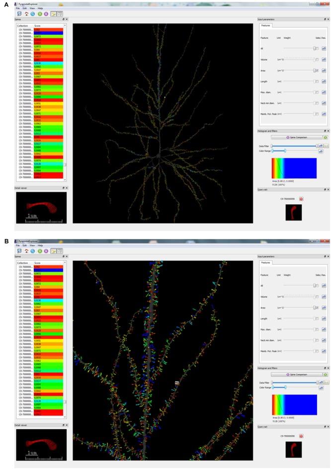https://cdn.ncbi.nlm.nih.gov/pmc/blobs/440c/4701943/b1fd10db81bf/fnana-09-00159-g004.jpg