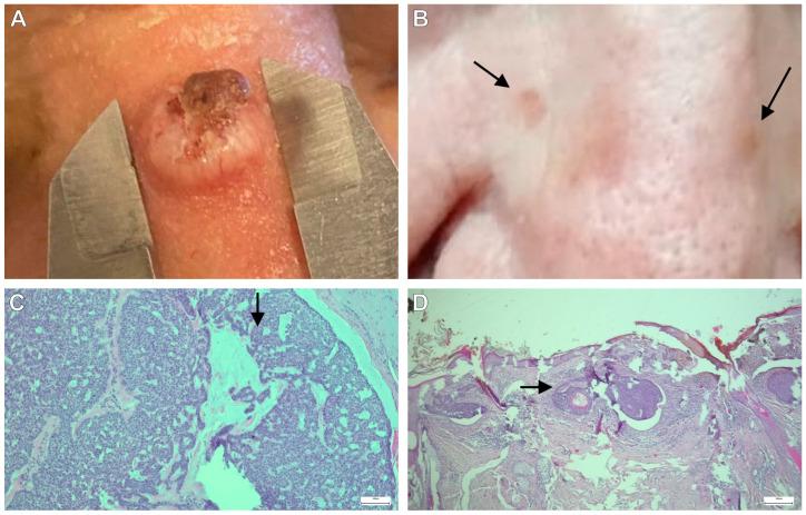 https://cdn.ncbi.nlm.nih.gov/pmc/blobs/440f/11355647/65da79f6dc78/jcm-13-04923-g004.jpg
