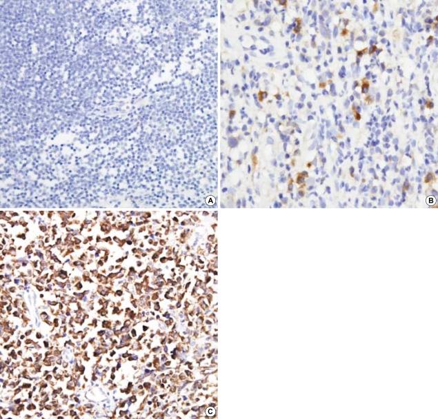 https://cdn.ncbi.nlm.nih.gov/pmc/blobs/4416/2729885/d0bda1398a4a/jkms-21-645-g001.jpg
