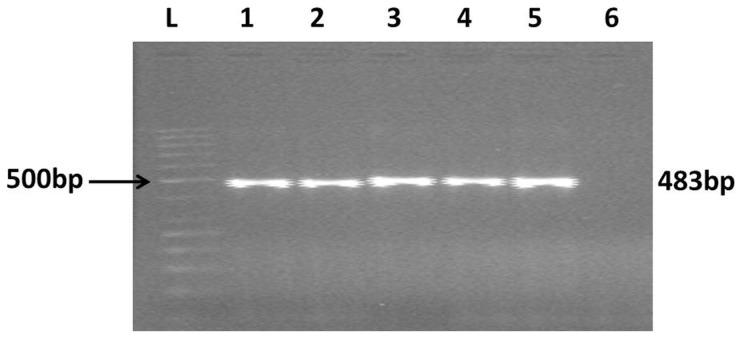 https://cdn.ncbi.nlm.nih.gov/pmc/blobs/4416/3907360/f290ee647d7e/pntd.0002605.g001.jpg
